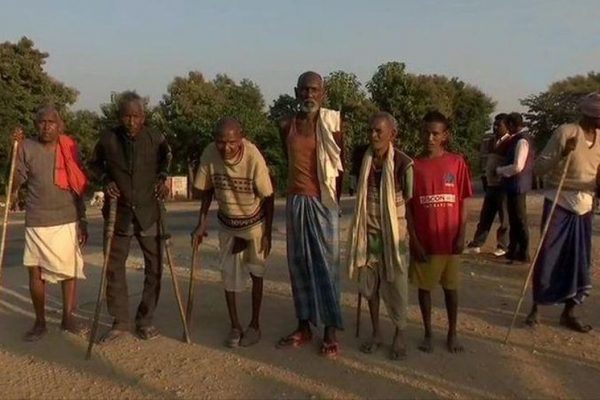 Locals of Jharkhand Village are suffering from Excessive Fluoride in Drinking Water