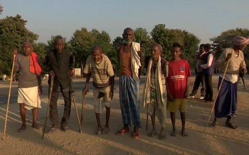 Locals of Jharkhand Village are suffering from Excessive Fluoride in Drinking Water