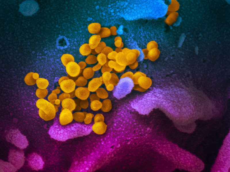 COVID19 Coronavirus electron microscope image