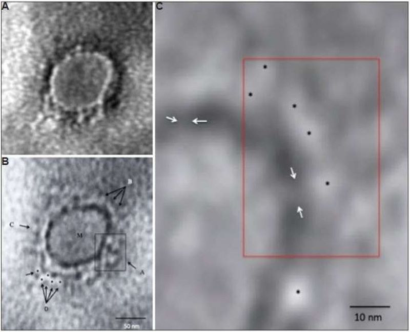 revealed the microscopy images of COVID-19 coronavirus