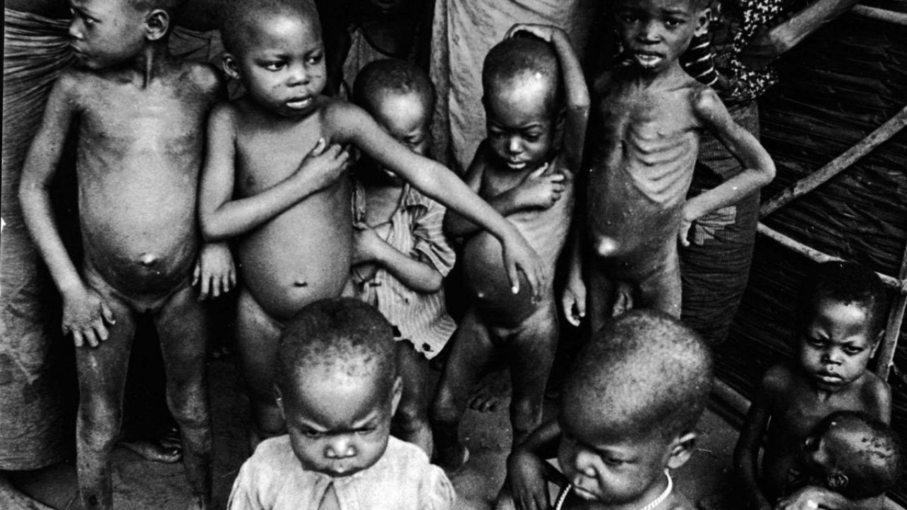 Hunger and Starvation Across the World is Affecting Half of Human Race