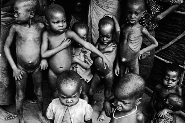 Hunger and Starvation Affecting Half the Human Race Across the World