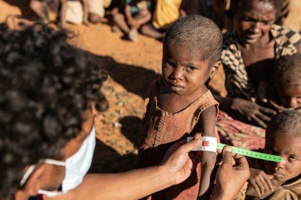 Africa’s Madagascar on the verge of climate change-induced famine