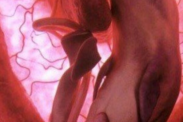 Little Dolphin in the womb